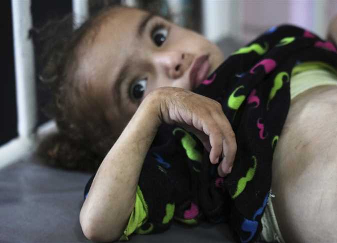 صوت غزة 13 مجاعة في غاية الخطورة