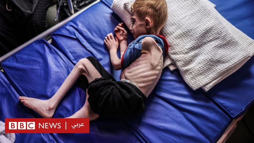 صوت غزة 16 الاف الاطفال معرضين للموت بسبب الجوع والحصار