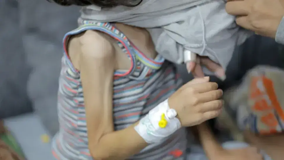 صوت غزة 12 مجاعة تنهش لحوم الاطفال